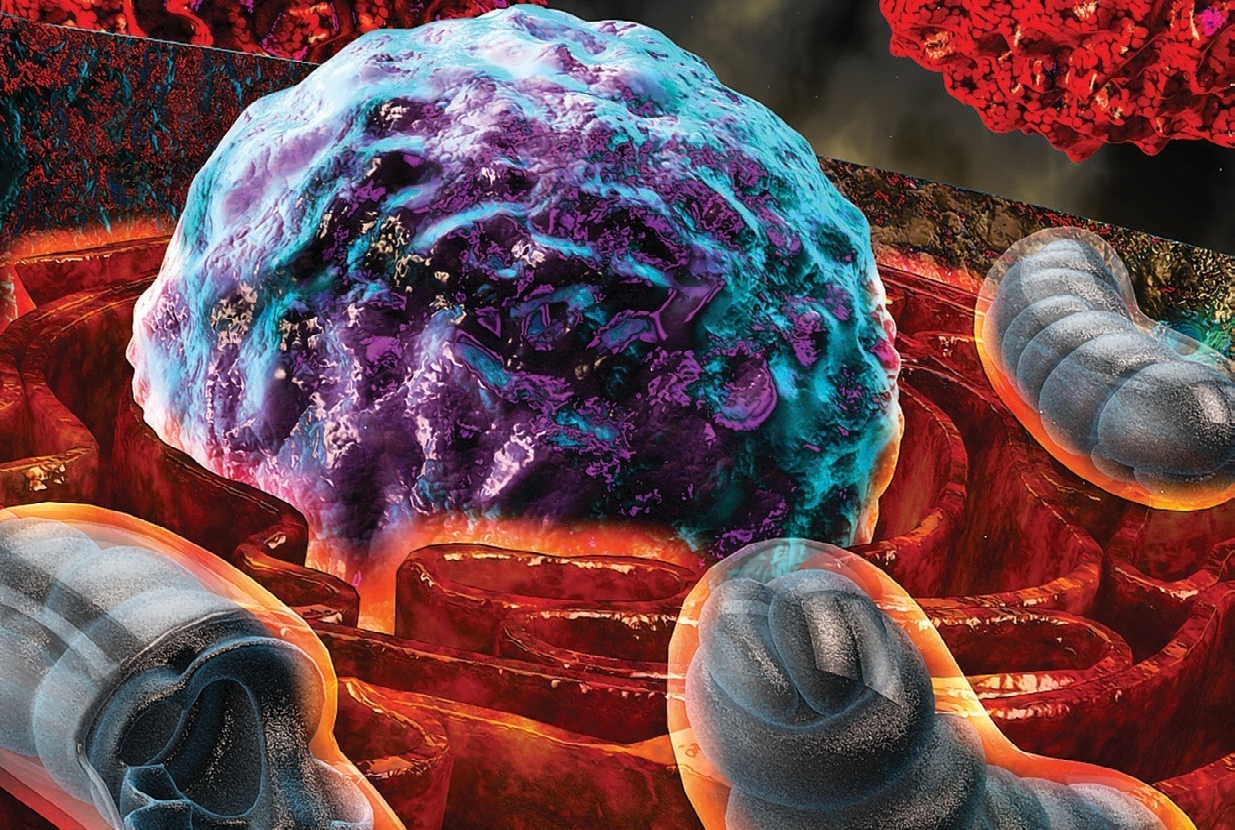 Stressful Situation: A scientific illustration shows how T-cells that are exposed to harsh conditions inside a tumor experience endoplasmic reticulum (ER) stress, depicted by “burning” ER (orange) surrounding the nucleus (purple and turquoise). Mitochondria are seen in bluish gray, with cancer cells in red. Credit: Ella Maru Studio