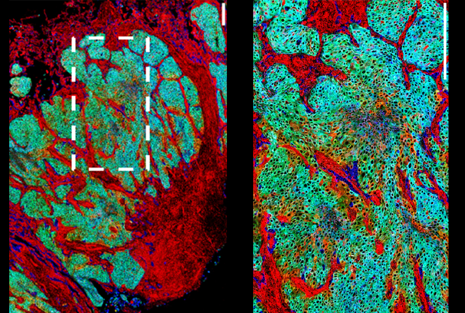 green and red labeled cells generated by imaging mass cytometry