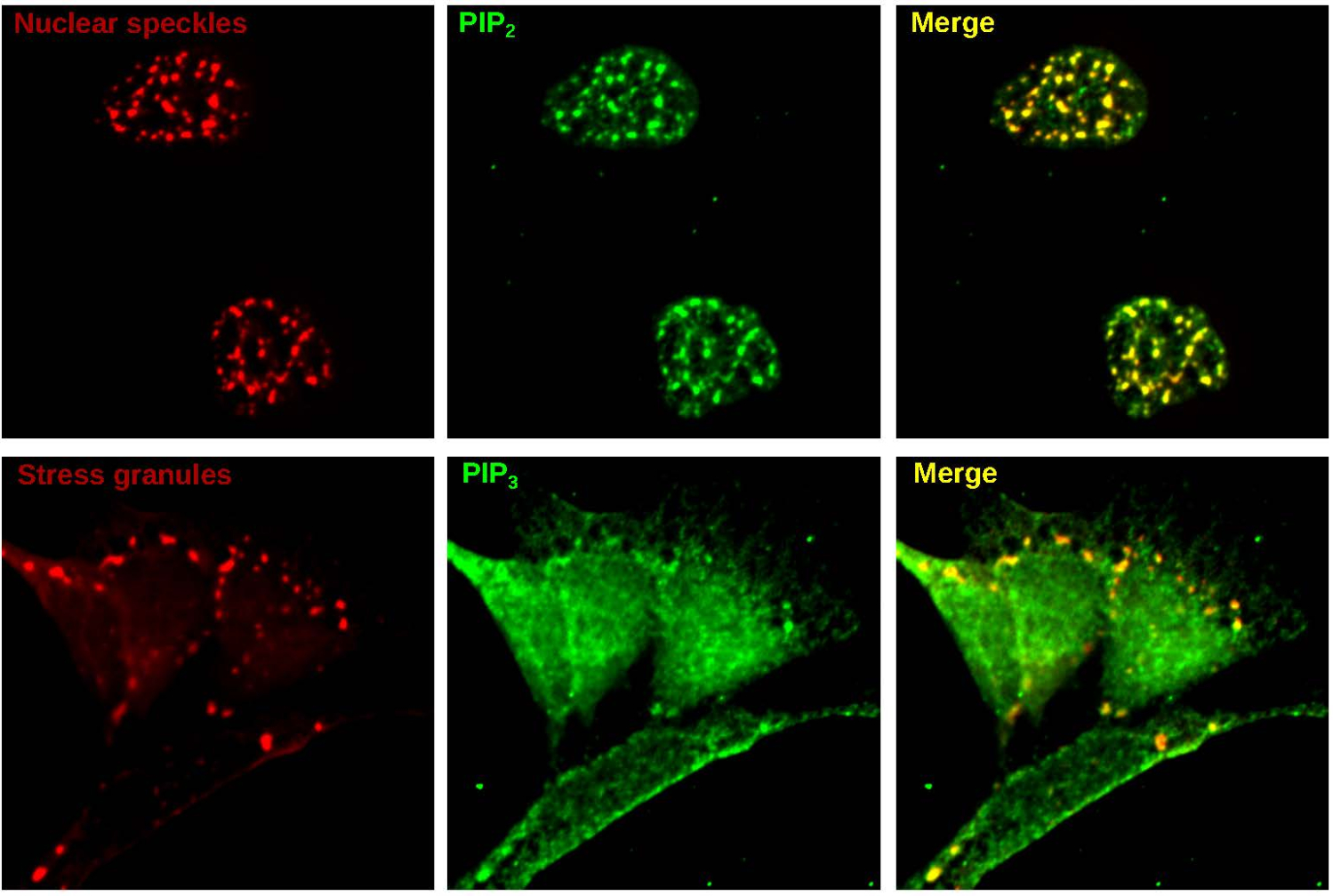 immunofluorescence image showing phospholipids in condensates