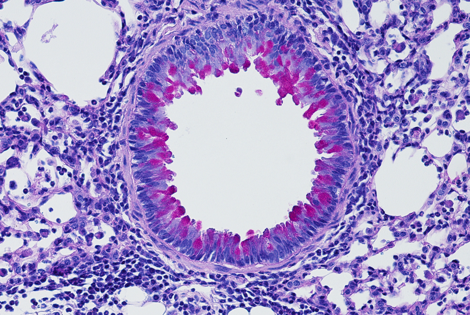 Nervous System Puts the Brakes on Inflammation