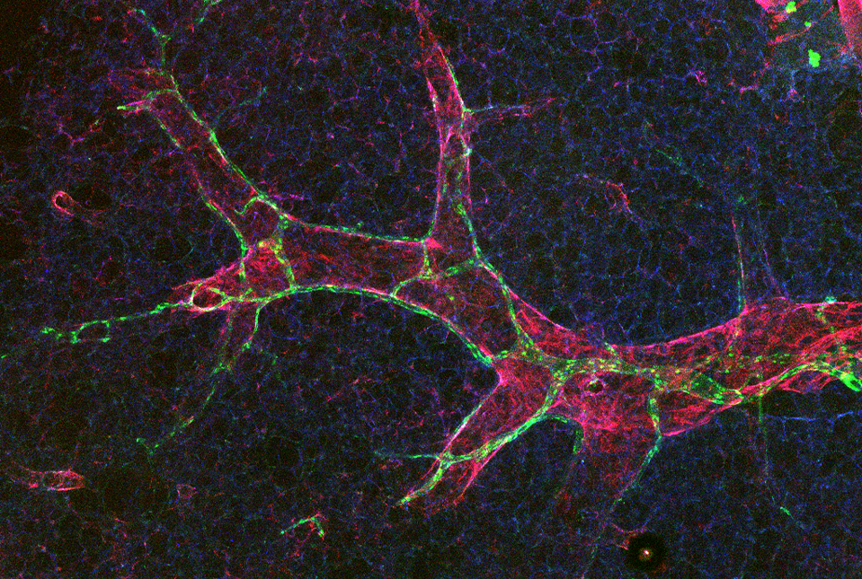 lymphatic vessels