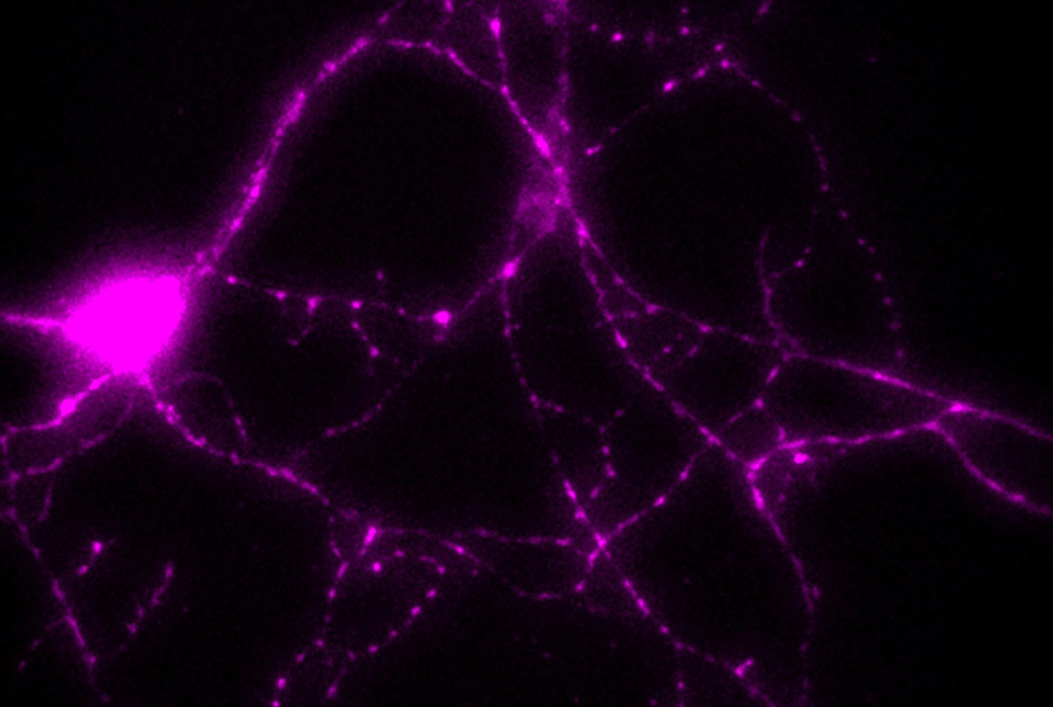 immunofluorescence image of a hippocampal neuron stained for PGK1