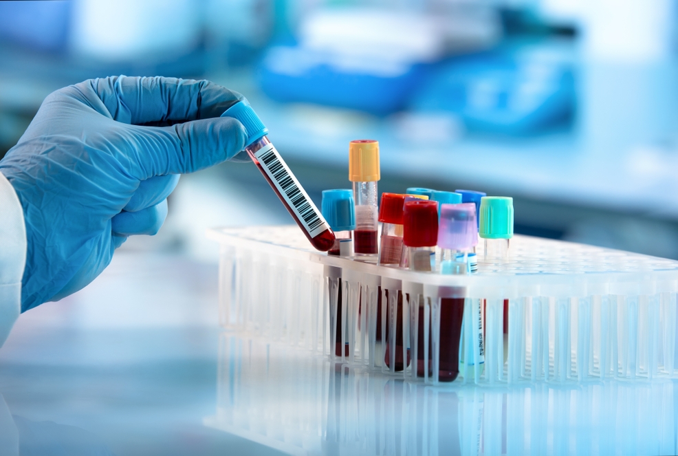 gloved hand holding lab tube