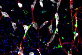 This image shows cancer cells (white) and pericytes (green) clinging to capillaries (red). The blue dots are nuclei.