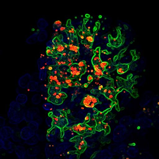 cx3cr1_mononuclear_phagocytes_green_in_the_intestinal_villi_blue_uptake_candida_albicans_red