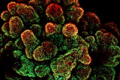 Human tissue platform for colon cancer drug testing