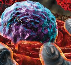 Stressful Situation: A scientific illustration shows how T-cells that are exposed to harsh conditions inside a tumor experience endoplasmic reticulum (ER) stress, depicted by “burning” ER (orange) surrounding the nucleus (purple and turquoise). Mitochondria are seen in bluish gray, with cancer cells in red. Credit: Ella Maru Studio