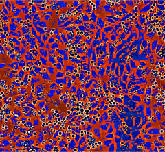 colorized greyscale image of blood cells expanding on top of vascular endothelial cells