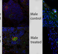 Immunofluorescent image of cells tagged with red, green and blue labels