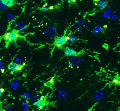 inflammatory microglia stained green and yellow