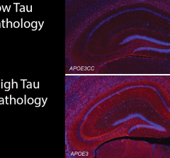 Immunofluorescent image of mouse hippocampus stained for tau
