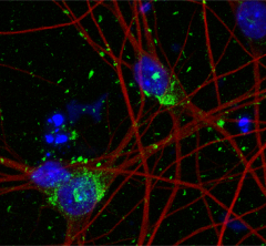 image showing cells stained blue, tau aggregates in green and neuron cytoskeleton in red