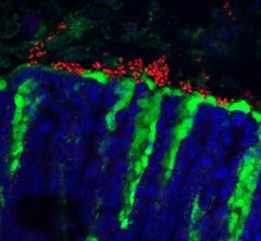 immunofluorescence image of mouse stomach with fungus stained red