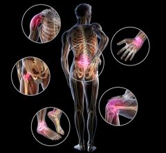 illustration of the different joints affected in spondyloarthritis