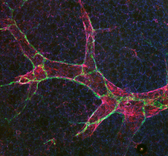 lymphatic vessels
