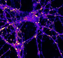 Neurons stained for lipid droplets