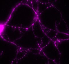 immunofluorescence image of a hippocampal neuron stained for PGK1