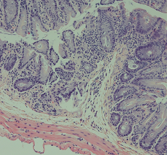 purple and pink stained intestinal cells