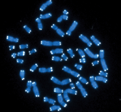chromosomes with telomeres
